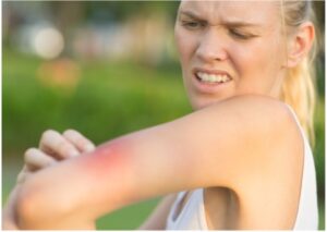 mosquito pest control